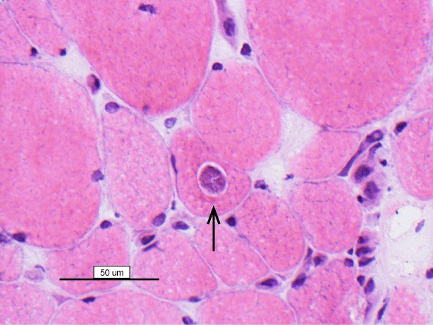 Cryostat section, haematoxylin-eosin stain, x 400magnification