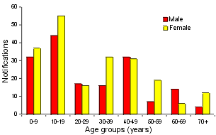 Figure 1. Notifications of pertussis, January 2000, by age group and sex