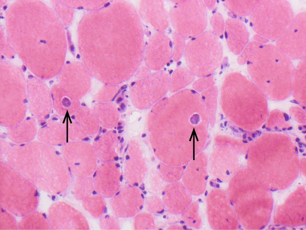 Cryostat section, haematoxylin-eosin stain, x 200 magnification