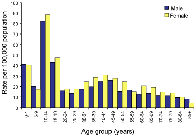 Figure 44. Notification rates for pertussis, Australia, 2002, by age group and sex