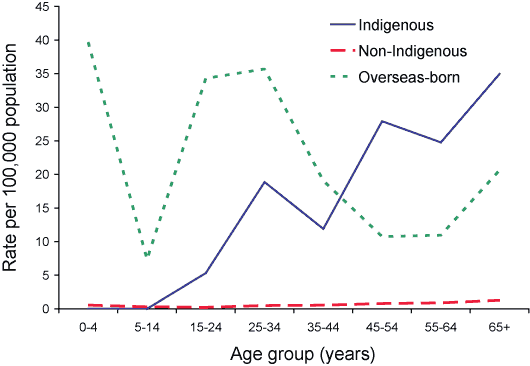Figure 4. Tuberculosis incidence in Australian-born and overseas-born, 2004, by age