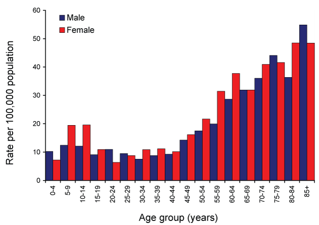 Figure 48:  Notification rate for shingles, Australia, 2007, by age group and sex