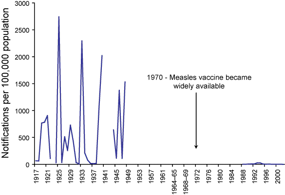 Measles, 1917 to 2002