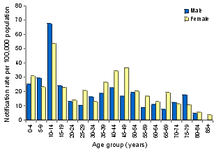 Figure 4. Notification rate of pertussis, first quarter 2001, by age group and sex
