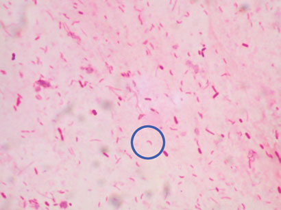 Figure 2. Curved Gram negative rods - Vibrio cholerae