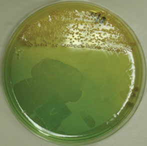 Figure 3. Selective medium (TCBS) showing typical yellow colonies