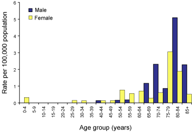 Figure 21. Notification rates of listeriosis, Australia, 2002, by age group and sex