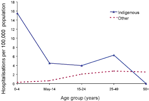 Figure 2. Hepatitis A hospitalisation rate, Australia, 1999 to 2002, by age group and Indigenous status