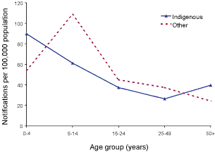 Figure 9. Pertussis notification rate, selected Australian States, 2000 to 2002, by age group and Indigenous status