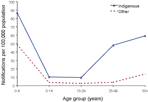 Figure 11. Invasive pneumococcal disease notification rate, selected Australian States, 2001 to 2002, by age group and Indigenous status
