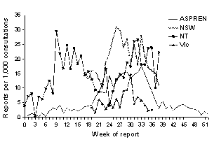 Figure 8. Sentinel general practioner consultation rates, influenza-like illness, 1999, by week and sentinel surveillance scheme