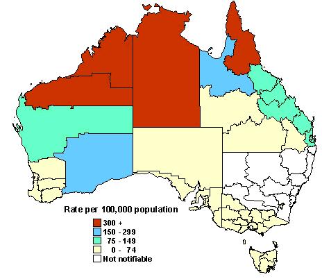 Map 5. Notification rate of chlamydial infection, 1997, by Statistical Division of residence